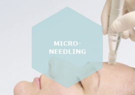 Micro-Needling Berlin